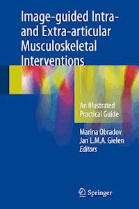 Image-guided Intra- and Extra-articular Musculoskeletal Interventions -  - E-Book