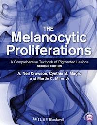 The Melanocytic Proliferations - A. Neil Crowson - E-Book