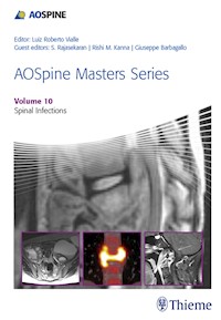 AOSpine Masters Series, Volume 10: Spinal Infections - - E-Book