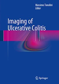 Imaging of Ulcerative Colitis -  - E-Book