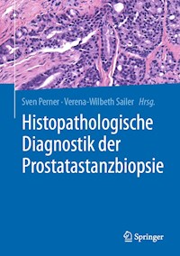 Histopathologische Diagnostik der Prostatastanzbiopsie - Sven Perner - E-Book