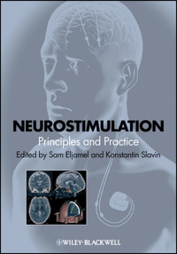 Neurostimulation -  - E-Book