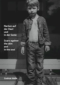 Narben auf der Haut und in der Seele - Gudrun Holtz - E-Book