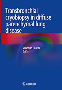 Transbronchial cryobiopsy in diffuse parenchymal lung disease -  - E-Book
