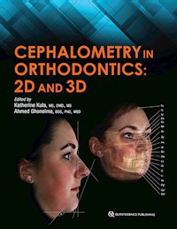 Cephalometry in Orthodontics - Katherine Kula - E-Book