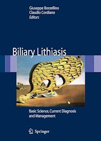 Biliary Lithiasis -  - E-Book
