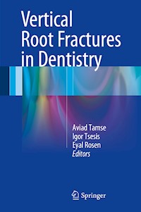 Vertical Root Fractures in Dentistry -  - E-Book