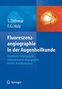 Fluoreszenzangiographie in der Augenheilkunde - Stefan Dithmar - E-Book