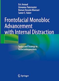 Frontofacial Monobloc Advancement with Internal Distraction - Eric Arnaud - E-Book