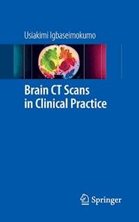 Brain CT Scans in Clinical Practice - Usiakimi Igbaseimokumo - E-Book