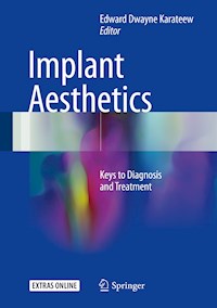 Implant Aesthetics -  - E-Book