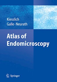 Atlas of Endomicroscopy -  - E-Book