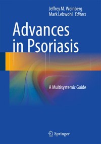 Advances in Psoriasis -  - E-Book