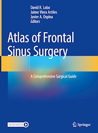 Atlas of Frontal Sinus Surgery -  - E-Book