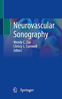 Neurovascular Sonography -  - E-Book