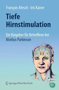 Tiefe Hirnstimulation: Ein Ratgeber für Betroffene bei Morbus Parkinson - François Alesch - E-Book
