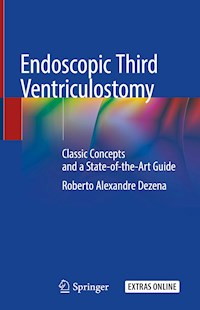 Endoscopic Third Ventriculostomy - Roberto Alexandre Dezena - E-Book
