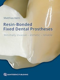 Resin-Bonded Fixed Dental Prostheses - Matthias Kern - E-Book