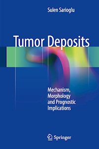 Tumor Deposits - Sulen Sarioglu - E-Book