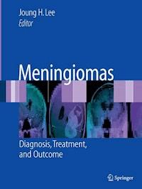 Meningiomas -  - E-Book