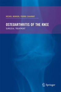 Osteoarthritis of the knee -  - E-Book
