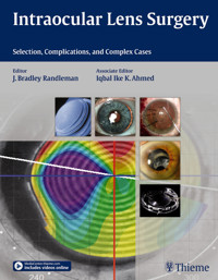 Intraocular Lens Surgery - Bradley Randleman - E-Book