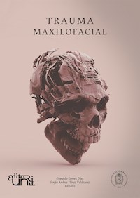 Trauma maxilofacial -  - E-Book