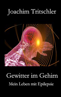 Gewitter im Gehirn - Joachim Tritschler - E-Book