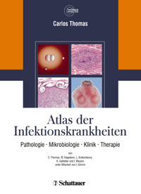 Atlas der Infektionskrankheiten - Carlos Thomas - E-Book