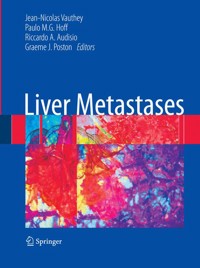 Liver Metastases -  - E-Book