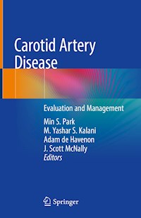 Carotid Artery Disease -  - E-Book