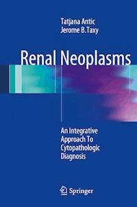 Renal Neoplasms - Tatjana Antic - E-Book