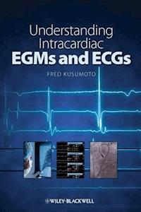 Understanding Intracardiac EGMs and ECGs - Fred Kusumoto - E-Book