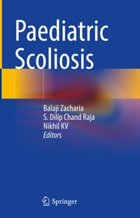 Paediatric Scoliosis -  - E-Book