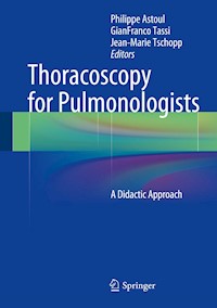 Thoracoscopy for Pulmonologists -  - E-Book