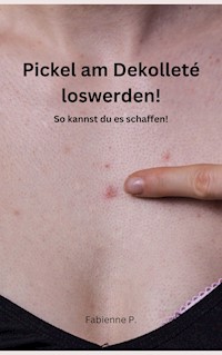 Pickel am Dekolleté loswerden! - Fabienne P. - E-Book