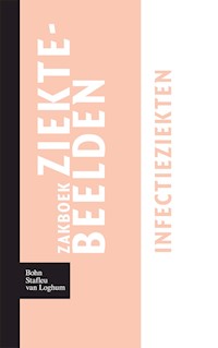 Zakboek ziektebeelden Infectieziekten - Karin Linden - E-Book