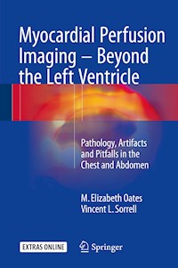Myocardial Perfusion Imaging - Beyond the Left Ventricle - M. Elizabeth Oates - E-Book
