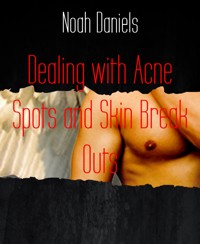 Dealing with Acne Spots and Skin Break Outs - Noah Daniels - E-Book