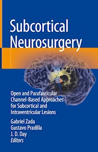 Subcortical Neurosurgery -  - E-Book