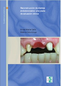 Reconstrucción de dientes endodonciados - Ernest Mallat Callís - E-Book