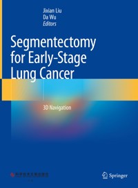Segmentectomy for Early-Stage Lung Cancer -  - E-Book