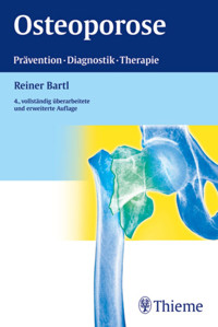 Osteoporose - Reiner Bartl - E-Book