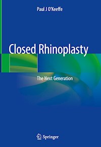 Closed Rhinoplasty - Paul J O'Keeffe - E-Book