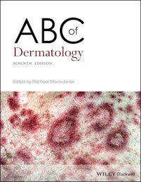 ABC of Dermatology -  - E-Book