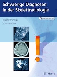 Schwierige Diagnosen in der Skelettradiologie - Jürgen Freyschmidt - E-Book