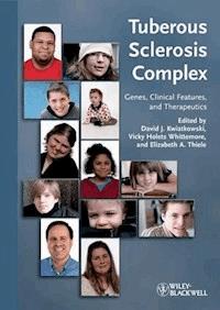 Tuberous Sclerosis Complex -  - E-Book