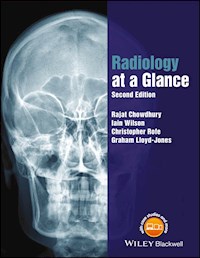 Radiology at a Glance - Rajat Chowdhury - E-Book