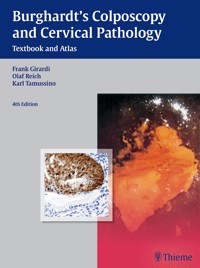 Burghardt's Colposcopy and Cervical Pathology - Erich Burghardt - E-Book