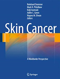 Skin Cancer - A World-Wide Perspective - - E-Book